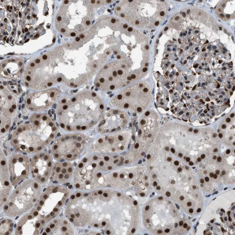KPNA6 Antibody - BSA Free Immunohistochemistry-Paraffin: KPNA6 Antibody [NBP1-83762]