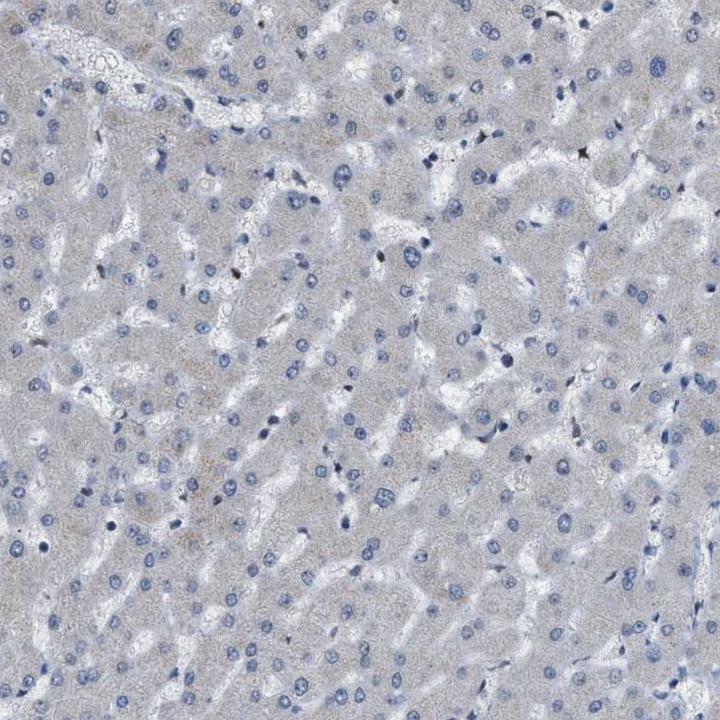 KPNA6 Antibody - BSA Free Immunohistochemistry-Paraffin: KPNA6 Antibody [NBP1-83762]