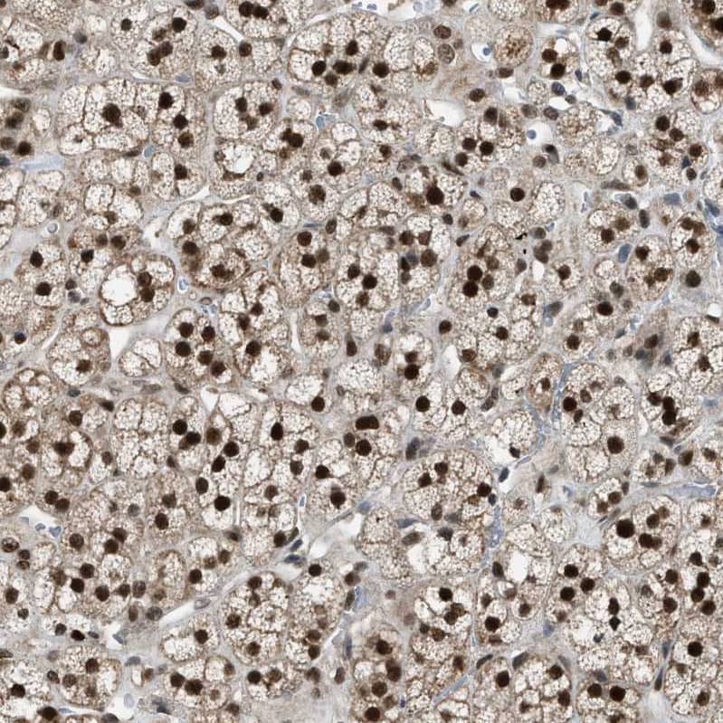 KPNA6 Antibody - BSA Free Immunohistochemistry-Paraffin: KPNA6 Antibody [NBP1-83762]