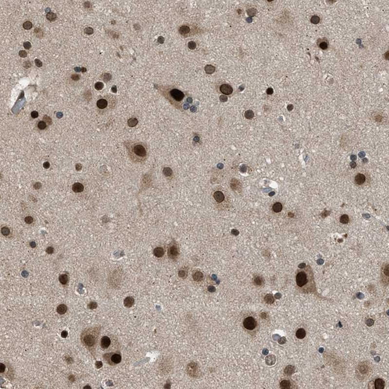KPNA6 Antibody - BSA Free Immunohistochemistry-Paraffin: KPNA6 Antibody [NBP1-83762]