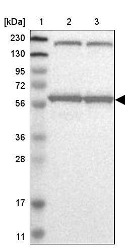 KPNA6 Antibody - BSA Free Western Blot: KPNA6 Antibody - BSA Free [NBP1-83762]