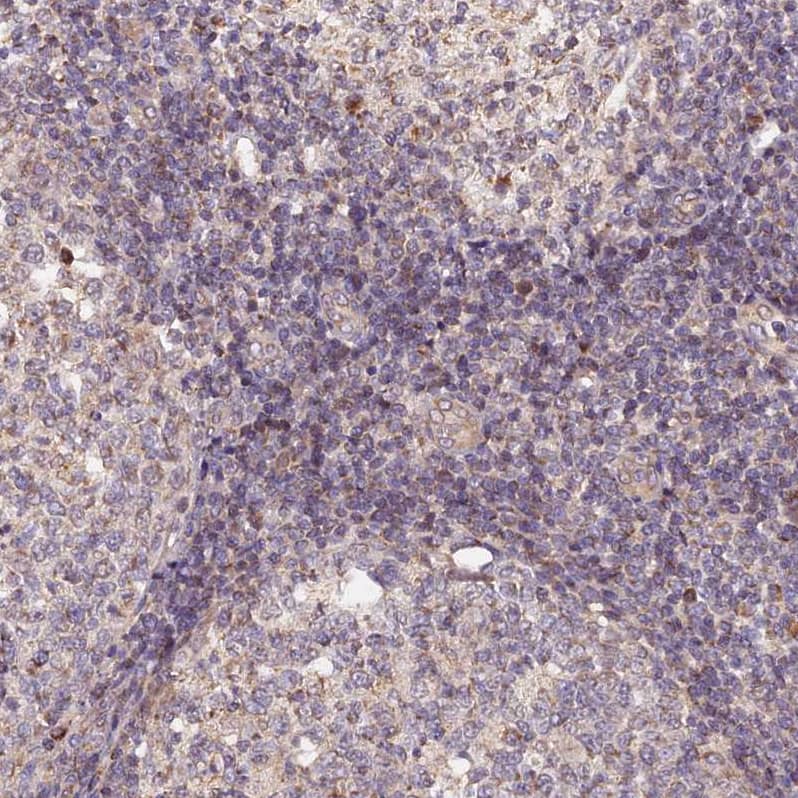 MNS1 Antibody - BSA Free Immunohistochemistry-Paraffin: MNS1 Antibody [NBP1-83764]