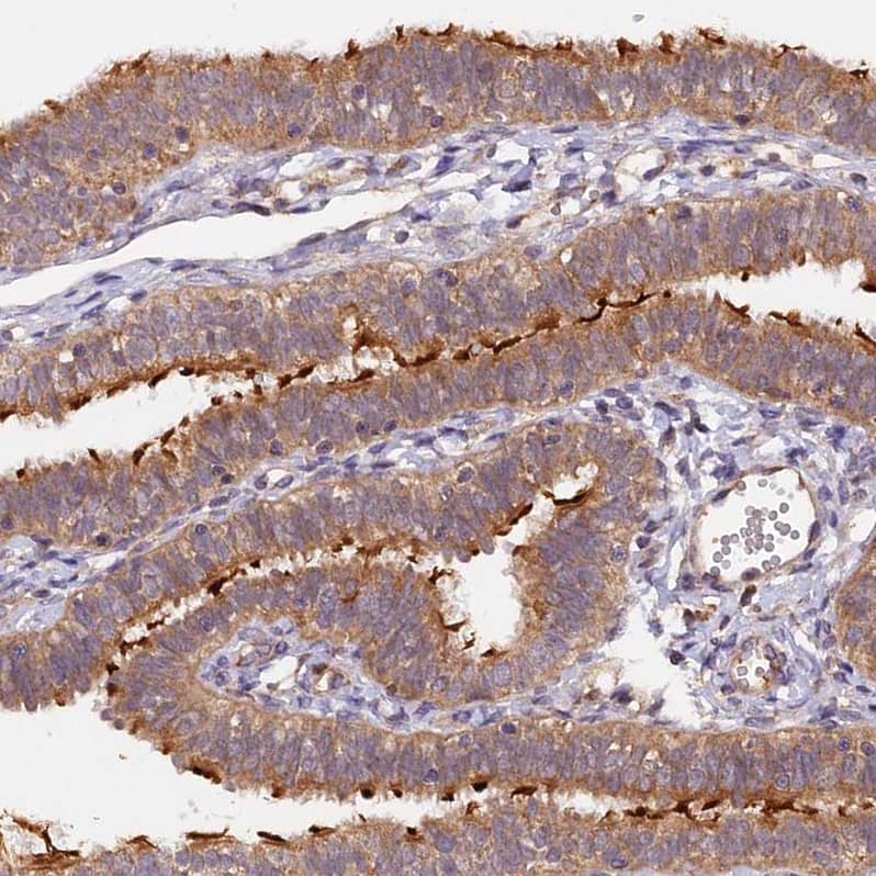 MNS1 Antibody - BSA Free Immunohistochemistry-Paraffin: MNS1 Antibody [NBP1-83764]