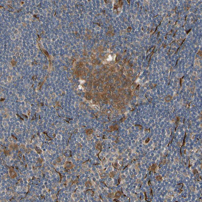 FGD6 Antibody - BSA Free Immunohistochemistry-Paraffin: FGD6 Antibody - BSA Free [NBP1-83770]