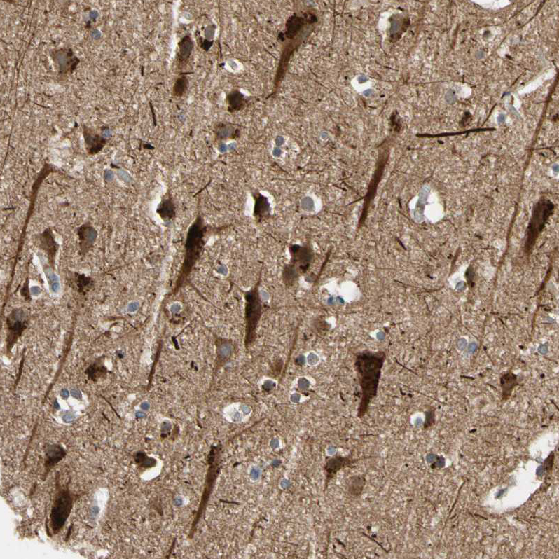 FGD6 Antibody - BSA Free Immunohistochemistry-Paraffin: FGD6 Antibody - BSA Free [NBP1-83770]