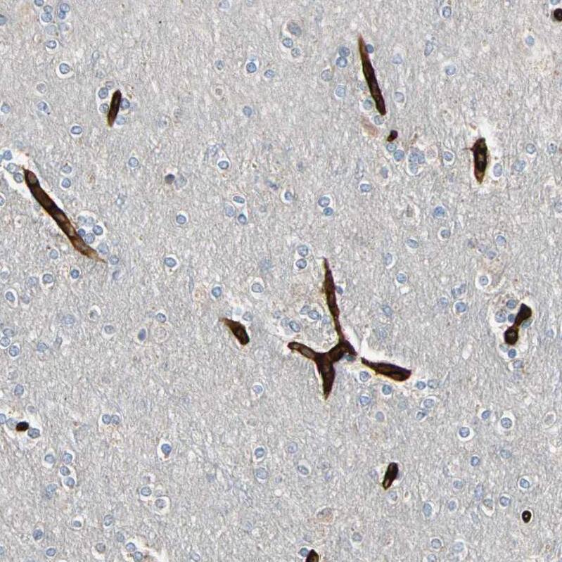 RIOK2 Antibody - BSA Free Immunohistochemistry-Paraffin: RIOK2 Antibody - BSA Free [NBP1-83773]