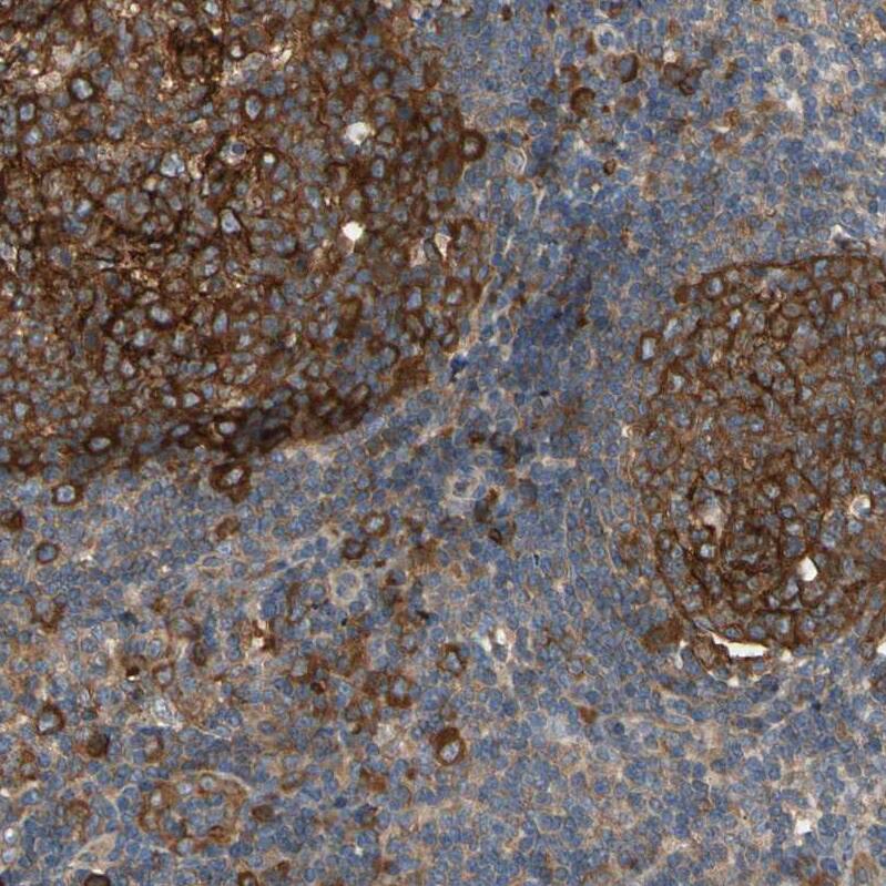 RIOK2 Antibody - BSA Free Immunohistochemistry-Paraffin: RIOK2 Antibody - BSA Free [NBP1-83773]