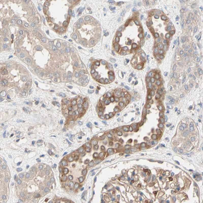 RIOK2 Antibody - BSA Free Immunohistochemistry-Paraffin: RIOK2 Antibody - BSA Free [NBP1-83773]