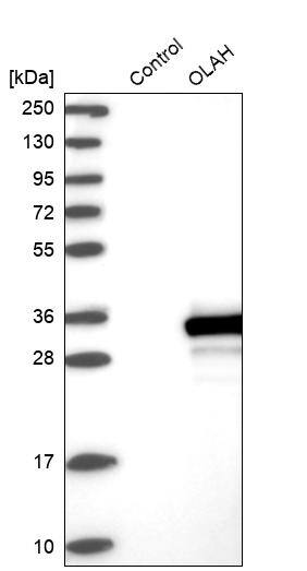 OLAH Antibody - BSA Free Western Blot: OLAH Antibody - BSA Free [NBP1-83780]