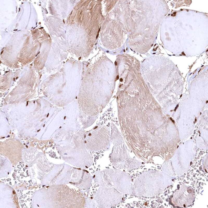 RSRC2 Antibody - BSA Free Immunohistochemistry-Paraffin: RSRC2 Antibody - BSA Free [NBP1-83787]