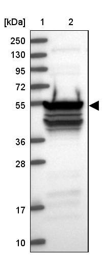 RBM41 Antibody - BSA Free Western Blot: RBM41 Antibody - BSA Free [NBP1-83788]