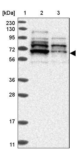 ZNF83 Antibody - BSA Free Western Blot: ZNF83 Antibody - BSA Free [NBP1-83789]