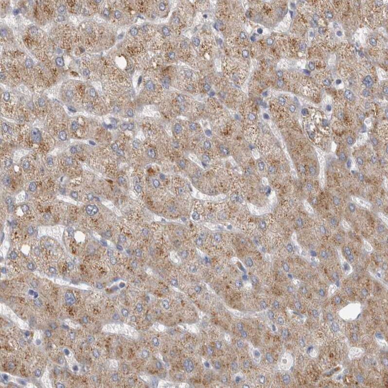 DHRS4 Antibody - BSA Free Immunohistochemistry-Paraffin: DHRS4 Antibody - BSA Free [NBP1-83790]