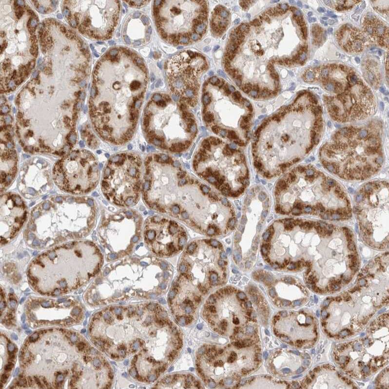DHRS4 Antibody - BSA Free Immunohistochemistry-Paraffin: DHRS4 Antibody - BSA Free [NBP1-83790]