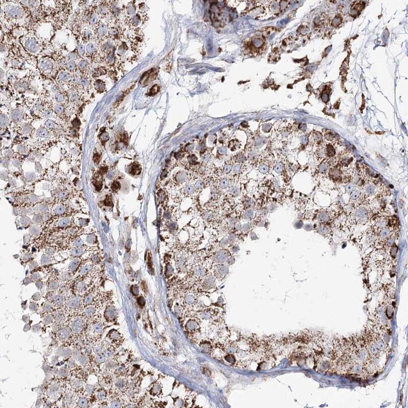 CWF19L1 Antibody - BSA Free Immunohistochemistry-Paraffin: CWF19L1 Antibody - BSA Free [NBP1-83794]