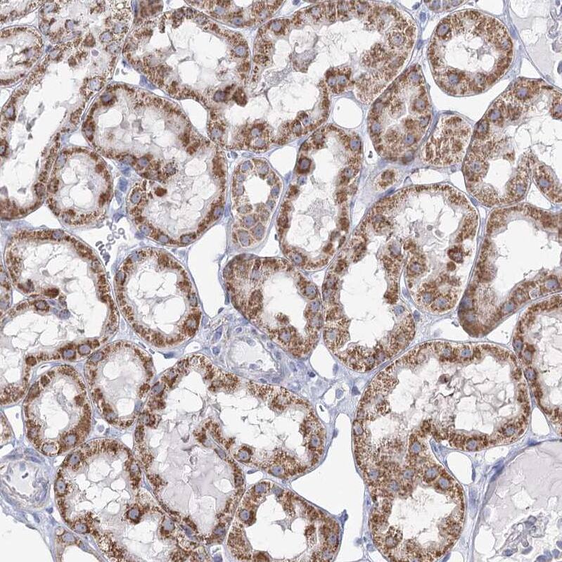 CWF19L1 Antibody - BSA Free Immunohistochemistry-Paraffin: CWF19L1 Antibody - BSA Free [NBP1-83794]