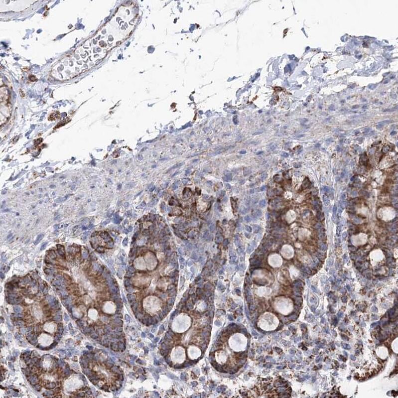 CWF19L1 Antibody - BSA Free Immunohistochemistry-Paraffin: CWF19L1 Antibody - BSA Free [NBP1-83794]