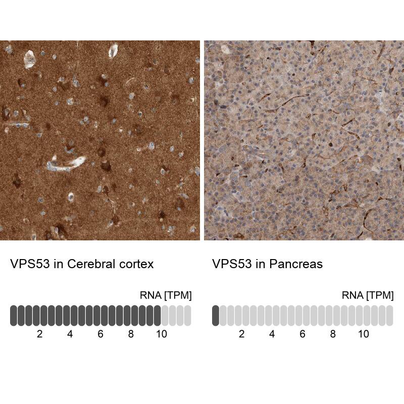 VPS53 Antibody - BSA Free Immunohistochemistry-Paraffin: VPS53 Antibody - BSA Free [NBP1-83798]