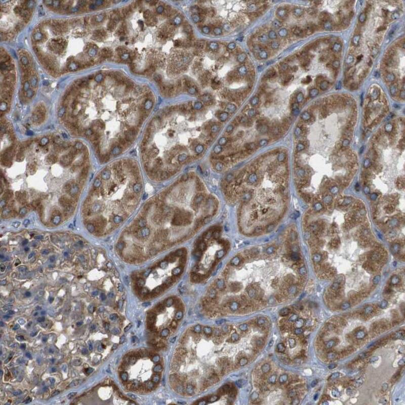 TMEM143 Antibody - BSA Free Immunohistochemistry-Paraffin: TMEM143 Antibody - BSA Free [NBP1-83809]