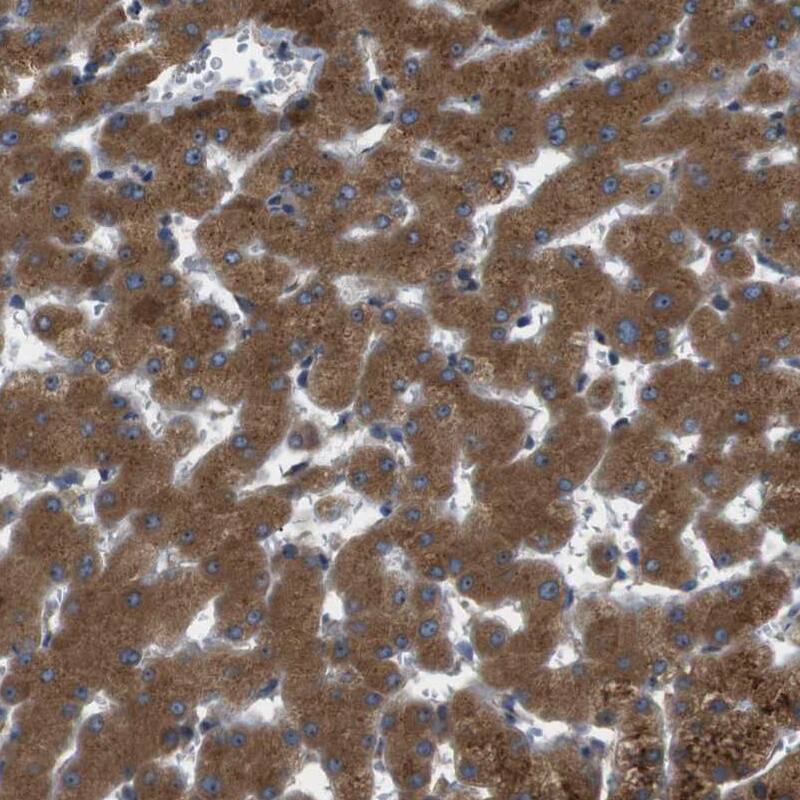 TMEM143 Antibody - BSA Free Immunohistochemistry-Paraffin: TMEM143 Antibody - BSA Free [NBP1-83809]