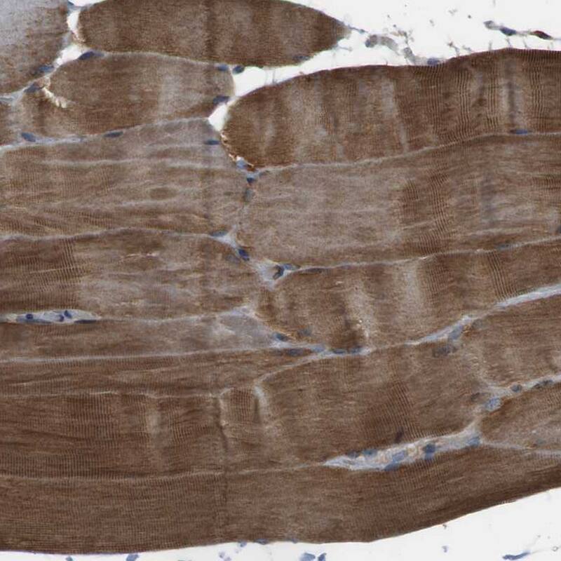 TMEM143 Antibody - BSA Free Immunohistochemistry-Paraffin: TMEM143 Antibody - BSA Free [NBP1-83809]