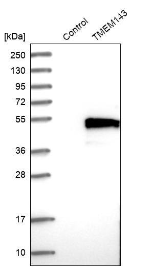 TMEM143 Antibody - BSA Free Western Blot: TMEM143 Antibody - BSA Free [NBP1-83809]
