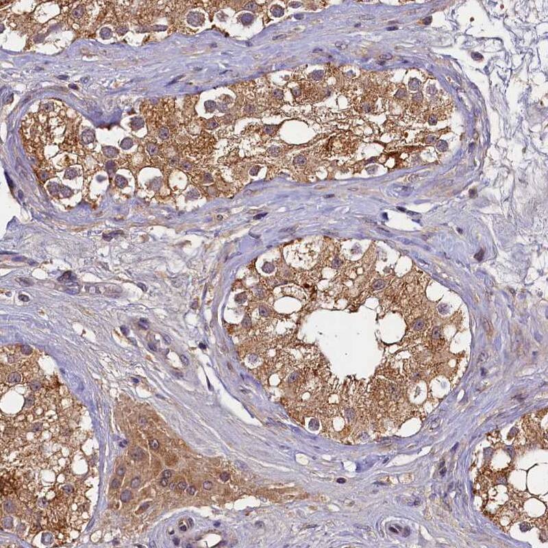 TMEM39A Antibody - BSA Free Immunohistochemistry-Paraffin: TMEM39A Antibody [NBP1-83813]