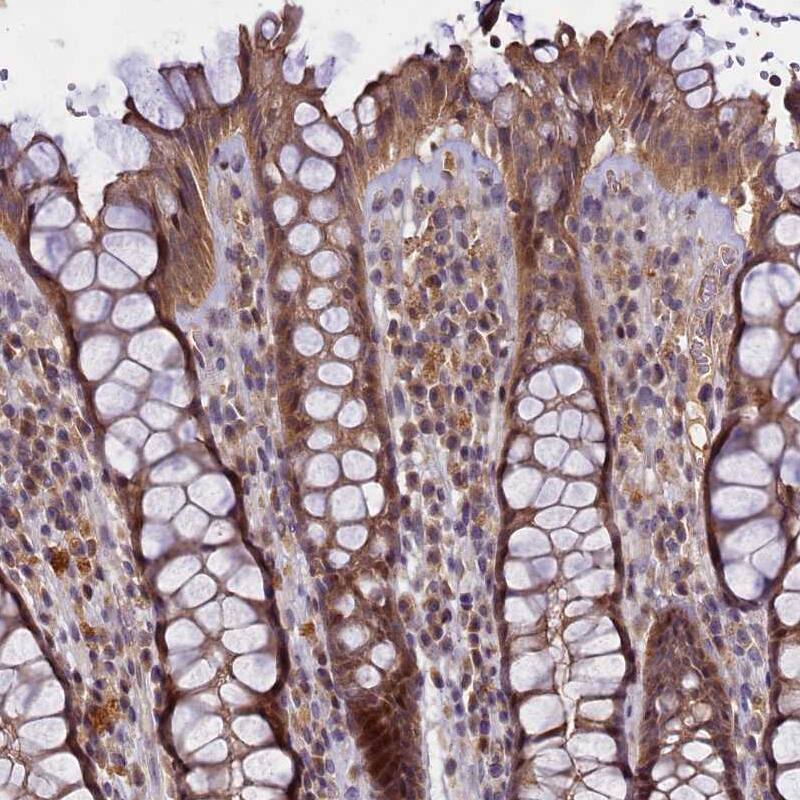 TMEM39A Antibody - BSA Free Immunohistochemistry-Paraffin: TMEM39A Antibody [NBP1-83813]