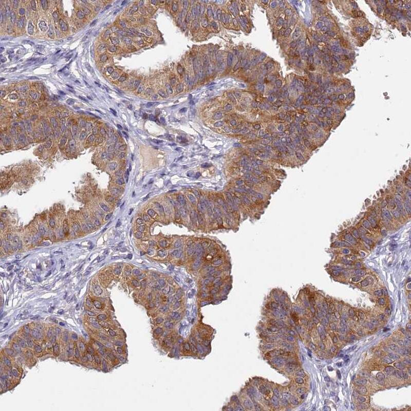 TMEM39A Antibody - BSA Free Immunohistochemistry-Paraffin: TMEM39A Antibody [NBP1-83813]