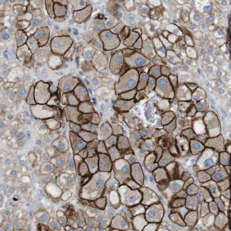 TYW1 Antibody - BSA Free Immunohistochemistry-Paraffin: TYW1 Antibody [NBP1-83814]