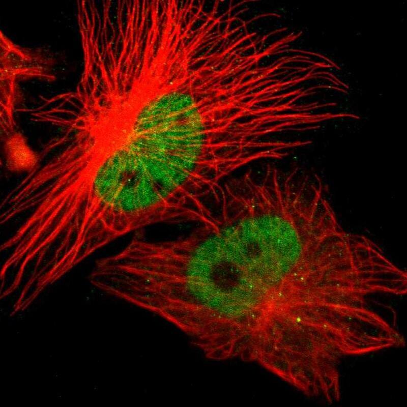 ZNF701 Antibody - BSA Free Immunocytochemistry/ Immunofluorescence: ZNF701 Antibody [NBP1-83815]