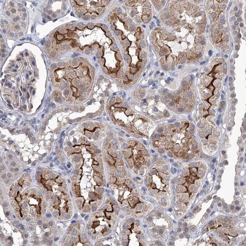TTC17 Antibody - BSA Free Immunohistochemistry-Paraffin: TTC17 Antibody [NBP1-83816]