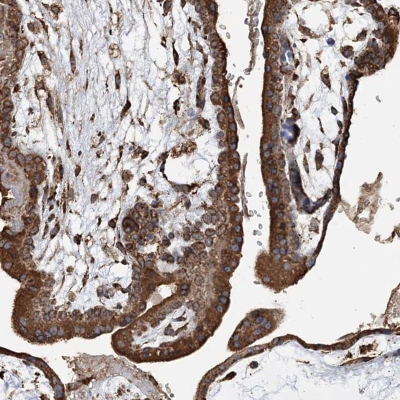 WDR12 Antibody Immunohistochemistry-Paraffin: WDR12 Antibody [NBP1-83818]