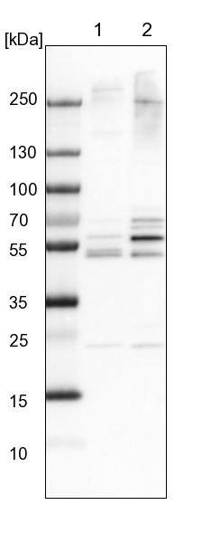 WDR12 Antibody Western Blot: SLC4A5 Antibody [NBP1-83818]