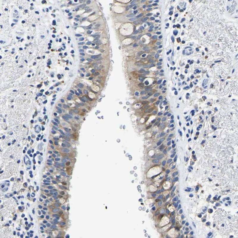 ZDHHC13 Antibody - BSA Free Immunohistochemistry-Paraffin: ZDHHC13 Antibody [NBP1-83822]
