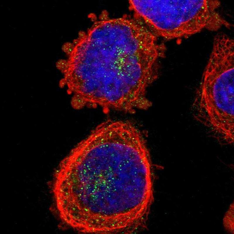 ZDHHC13 Antibody - BSA Free Immunocytochemistry/ Immunofluorescence: ZDHHC13 Antibody [NBP1-83823]