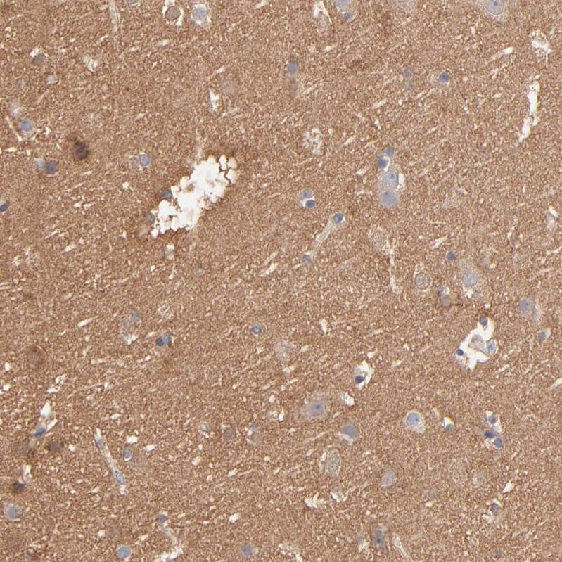 Septin-11 Antibody Immunohistochemistry-Paraffin: Septin-11 Antibody [NBP1-83824]