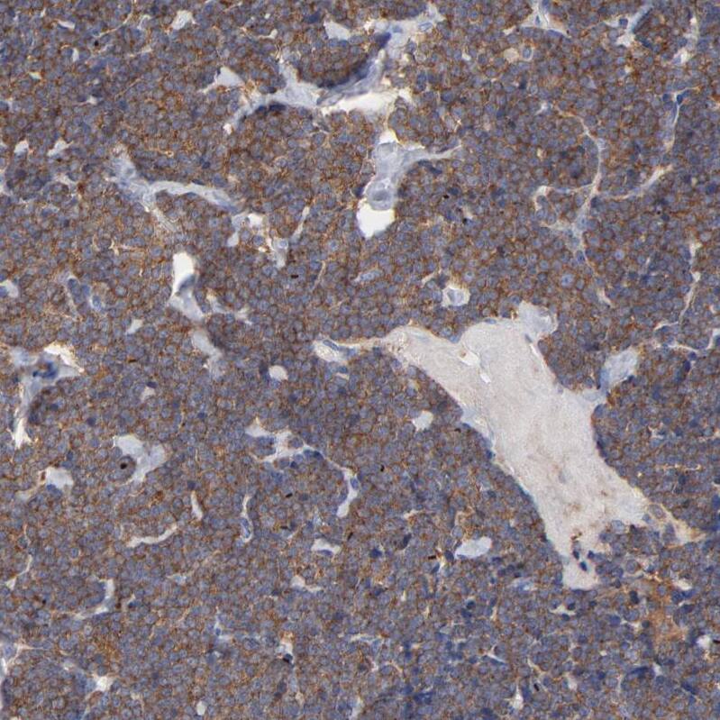 Septin-11 Antibody Immunohistochemistry-Paraffin: Septin-11 Antibody [NBP1-83824]