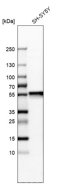 Septin-11 Antibody Western Blot: SNRPN Antibody [NBP1-83824]