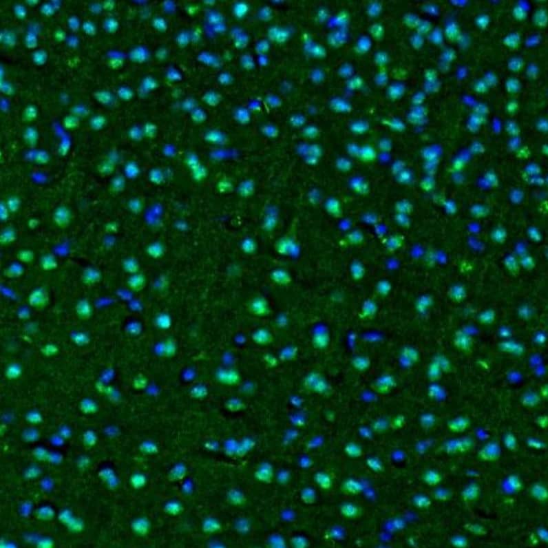 OGFOD1 Antibody - BSA Free Immunocytochemistry/ Immunofluorescence: OGFOD1 Antibody - BSA Free [NBP1-83826]