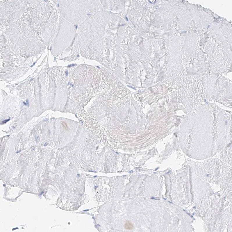 ZZEF1 Antibody - BSA Free Immunohistochemistry-Paraffin: ZZEF1 Antibody [NBP1-83828]