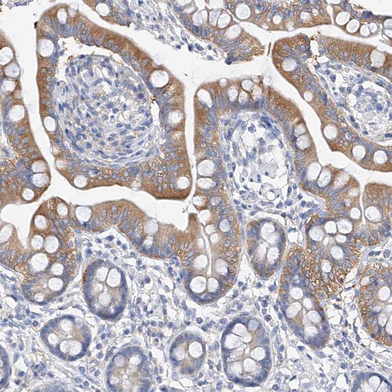 ZZEF1 Antibody - BSA Free Immunohistochemistry-Paraffin: ZZEF1 Antibody [NBP1-83828]