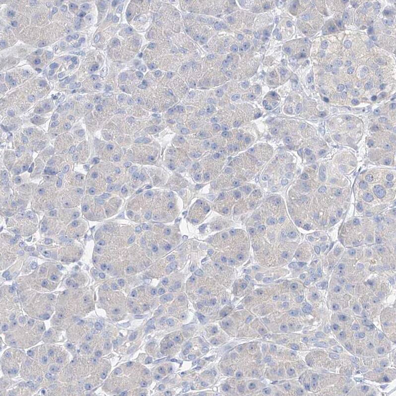 ZZEF1 Antibody - BSA Free Immunohistochemistry-Paraffin: ZZEF1 Antibody [NBP1-83828]
