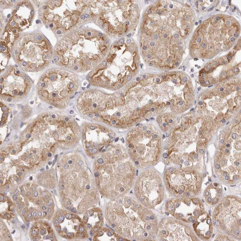 PANK4 Antibody - BSA Free Immunohistochemistry-Paraffin: PANK4 Antibody - BSA Free [NBP1-83832]