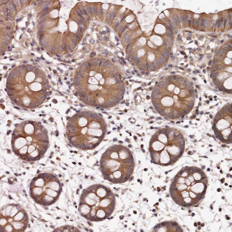 PANK4 Antibody - BSA Free Immunohistochemistry-Paraffin: PANK4 Antibody - BSA Free [NBP1-83832]