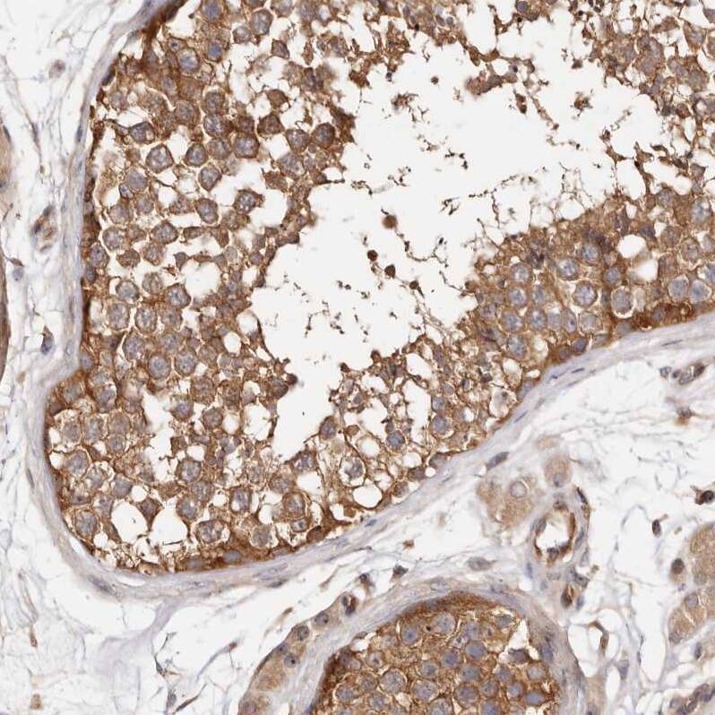 PANK4 Antibody - BSA Free Immunohistochemistry-Paraffin: PANK4 Antibody - BSA Free [NBP1-83832]