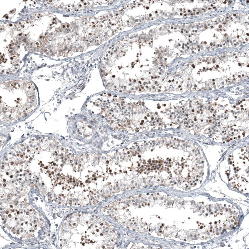 C1orf112 Antibody - BSA Free Immunohistochemistry-Paraffin: C1orf112 Antibody - BSA Free [NBP1-83835]
