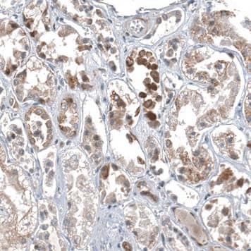 C1orf112 Antibody - BSA Free Immunohistochemistry-Paraffin: C1orf112 Antibody - BSA Free [NBP1-83835]