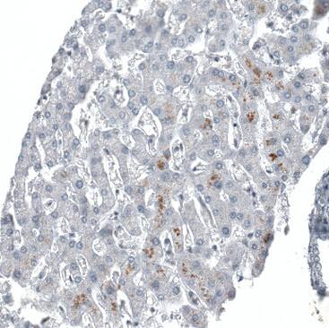 C1orf112 Antibody - BSA Free Immunohistochemistry-Paraffin: C1orf112 Antibody - BSA Free [NBP1-83835]