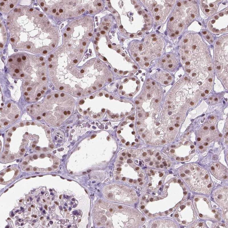 C1orf112 Antibody - BSA Free Immunohistochemistry-Paraffin: C1orf112 Antibody - BSA Free [NBP1-83836]